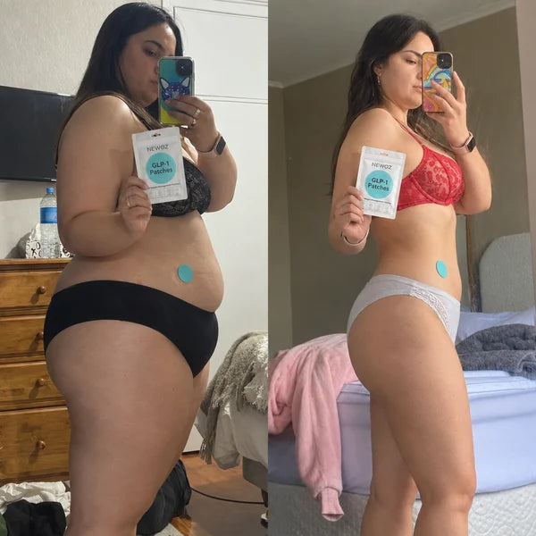 NEWOZ GLP-1 Patches Before and After Results